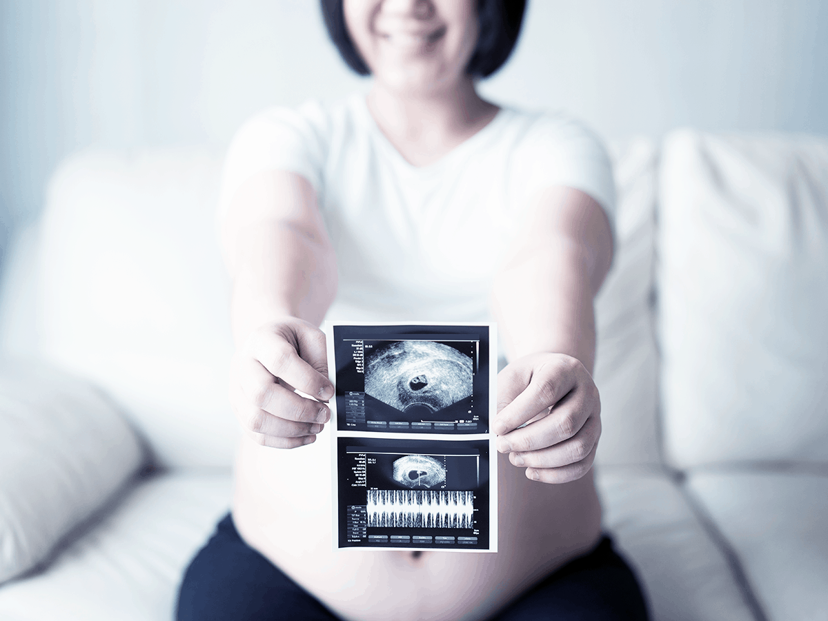 schwangerschaft-kinderwunsch-ultraschall-frauenarzt-praxis-aschaffenburg